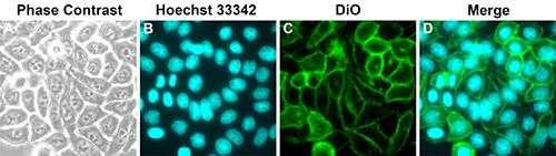 细胞膜染色剂-DIO细胞膜染料染色DLD1细胞-图3