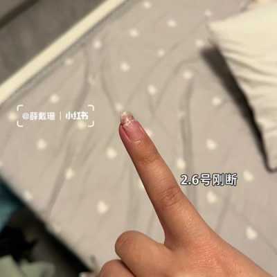 美甲指甲中间裂开如何修复图片-图2