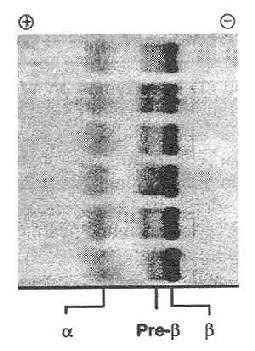 脂蛋白染色的染料（脂蛋白染色的染料是什么）-图1