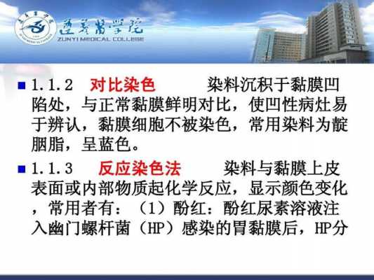 内镜下染色技术的分类及应用 染色内镜最常用的染料为-图3