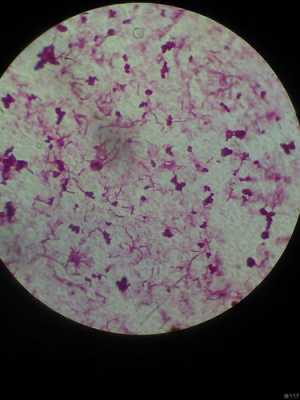 细菌染色是什么染料_细菌 染色-图3