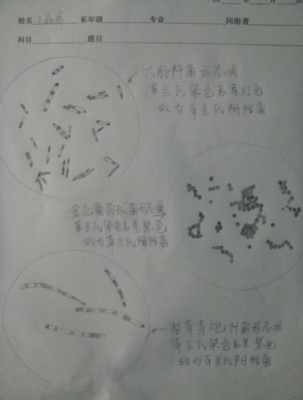 细菌简单染色中的碱性染料是什么-细菌简单染色中的碱性染料-图1