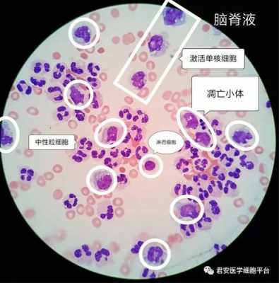 脑脊液革兰染色染料顺序_脑脊液涂片找到革兰阴性杆菌-图1