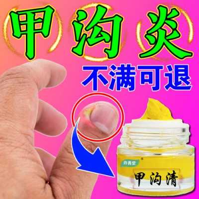 指甲炎症修复皮肤用什么药-指甲炎症修复皮肤-图2