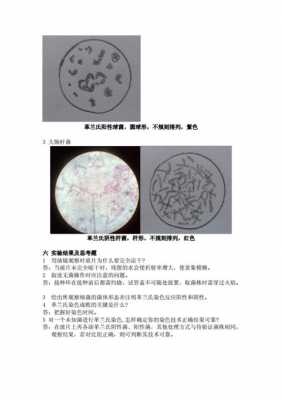 细菌染色是复合染料吗对吗-图2