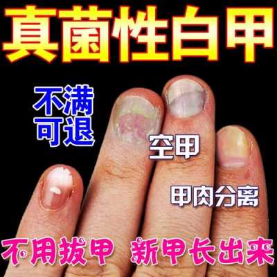 白色指甲修复,白色指甲修复液有用吗 -图1