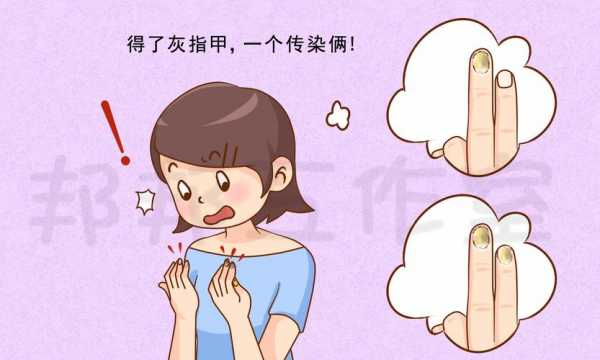 灰指甲激光修复动画图片_灰指甲激光疗法-图2