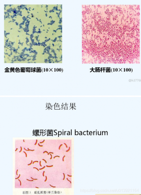 格兰染色法所用染料种类,格兰染色结果为什么是两种颜色? -图2