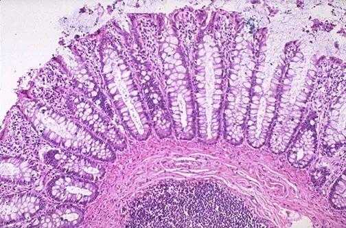 被碱性染料染色的细胞结构-能被碱性染料染色的有哪些-图1