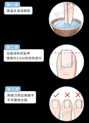 指甲修剪到什么程度-剪指甲修复周期多久-图3