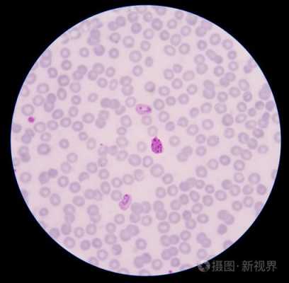 血液寄生虫染色什么染料（血液寄生虫会传染人吗）-图2