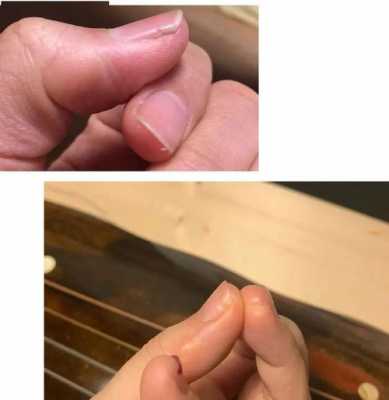 弹古琴指甲坏了怎么修复（弹古琴拇指指甲磨损）-图1