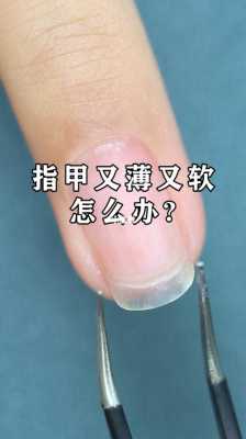 指甲软了如何修复好呢,指甲软的原因和处理方法 -图1