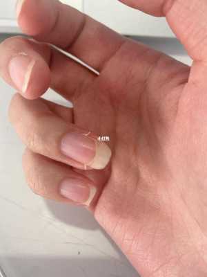 指甲剪裂怎么恢复 指甲分叉修复纸巾有用吗-图2