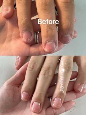  怪型指甲修复多少钱一次「修指甲形」-图3