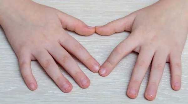  儿童指甲矫正修复步骤图解「儿童指甲修剪标准图片」-图2